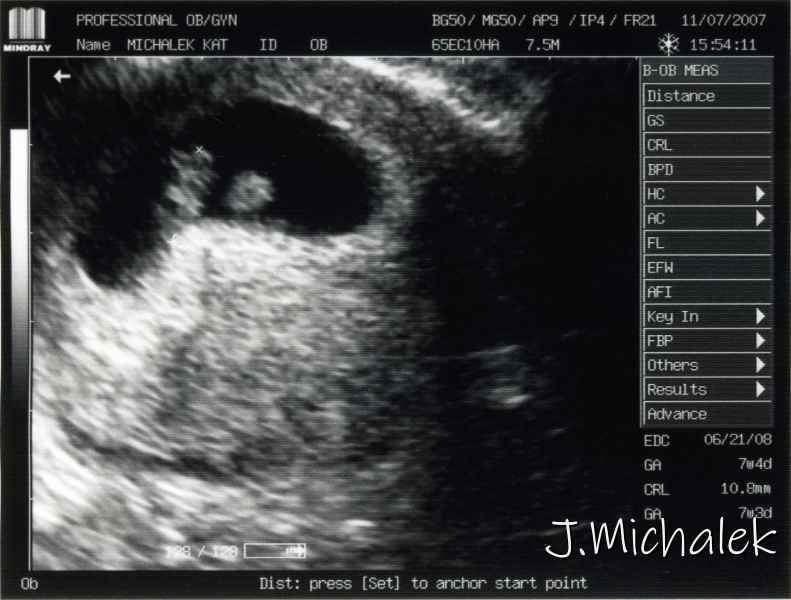 2007_1107_Baby2Ultrasound.jpg